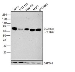 Invitrogen LIMP2 Recombinant Rabbit Monoclonal Antibody (22H6L14) 100 &mu;g;