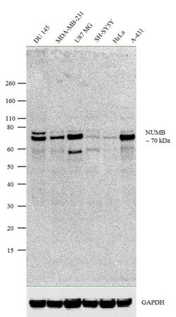 Invitrogen NUMB Recombinant Rabbit Monoclonal Antibody (14H45L9) 100 &mu;g;
