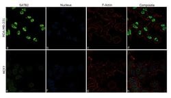 Invitrogen&trade;&nbsp;SATB2 Recombinant Rabbit Monoclonal Antibody (5H29L5)