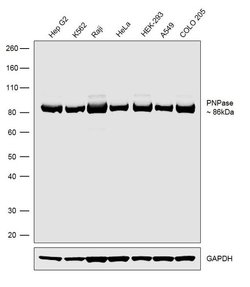 Invitrogen PNPase Recombinant Rabbit Monoclonal Antibody (24H24L10) 100 &mu;g | Buy Online | Invitrogen&trade; | Fisher Scientific