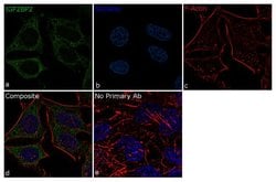 Invitrogen IGF2BP1 Recombinant Rabbit Monoclonal Antibody (18H5L31) 100