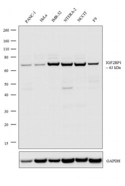Invitrogen IGF2BP1 Recombinant Rabbit Monoclonal Antibody (18H5L31) 100