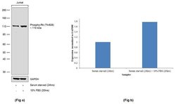 Invitrogen Phospho-Rb (Thr826) Recombinant Rabbit Monoclonal Antibody (17H6L55)