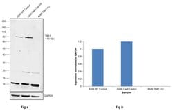 Invitrogen TBK1 Recombinant Rabbit Monoclonal Antibody (12H60L39) 100 &mu;g;