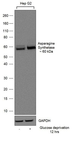 Invitrogen Asparagine Synthetase Recombinant Rabbit Monoclonal Antibody