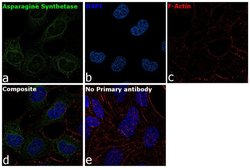 Invitrogen Asparagine Synthetase Recombinant Rabbit Monoclonal Antibody
