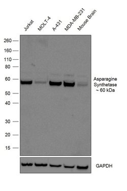 Invitrogen Asparagine Synthetase Recombinant Rabbit Monoclonal Antibody