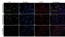 Invitrogen Axl Recombinant Rabbit Monoclonal Antibody (2H29L9) 100 &mu;g;