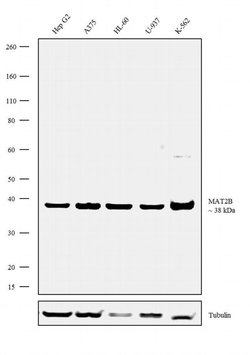 MAT2B Recombinant Rabbit Monoclonal Antibody (16H3L1):Antibodies, Recombinant