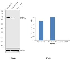 Invitrogen Ataxin 1 Recombinant Rabbit Monoclonal Antibody (16H8L13) 100