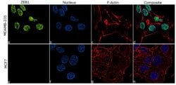 Invitrogen ZEB1 Recombinant Rabbit Monoclonal Antibody (13H12L8) 100 &mu;g;