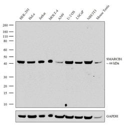SMARCB1 Recombinant Rabbit Monoclonal Antibody (3H7L9), Invitrogen 100