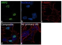 Invitrogen Arp2 Recombinant Rabbit Monoclonal Antibody (5H2L7) 100 &mu;g;