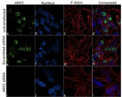 Invitrogen Arp2 Recombinant Rabbit Monoclonal Antibody (5H2L7) 100 &mu;g;