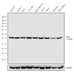 Invitrogen Arp2 Recombinant Rabbit Monoclonal Antibody (5H2L7) 100 &mu;g;