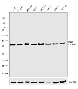 Invitrogen CDK9 Recombinant Rabbit Monoclonal Antibody (5H36L13) 100 &mu;g;