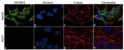 Invitrogen&trade;&nbsp;IGF2BP3 Recombinant Rabbit Monoclonal Antibody (6H33L68)