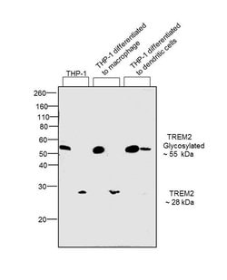 Invitrogen TREM2 Recombinant Rabbit Monoclonal Antibody (4H42L9) 100 &mu;g | Buy Online | Invitrogen&trade; | Fisher Scientific