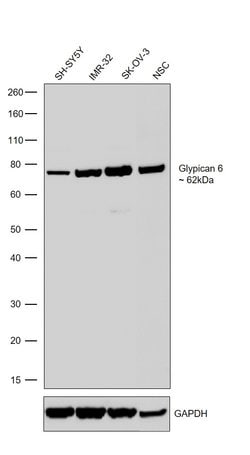 Invitrogen Glypican 6 Recombinant Rabbit Monoclonal Antibody (8H34L5) 100