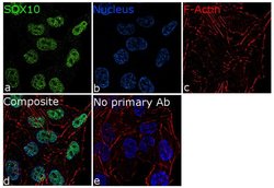 Invitrogen SOX10 Recombinant Rabbit Monoclonal Antibody (5H7L26) 100 &mu;g;