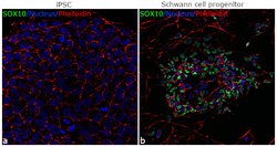 Invitrogen SOX10 Recombinant Rabbit Monoclonal Antibody (5H7L26) 100 &mu;g;