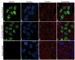 Invitrogen SOX10 Recombinant Rabbit Monoclonal Antibody (5H7L26) 100 &mu;g;
