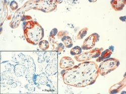 Invitrogen SSTR4 Recombinant Rabbit Monoclonal Antibody (7H49L61) 100 &mu;g;