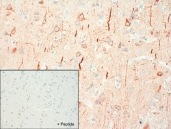 Invitrogen SSTR4 Recombinant Rabbit Monoclonal Antibody (7H49L61) 100 &mu;g;