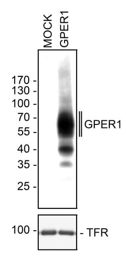 Invitrogen GPR30 Recombinant Rabbit Monoclonal Antibody (20H15L21) 100