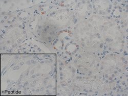 Invitrogen AVPR2 Recombinant Rabbit Monoclonal Antibody (7H28L47) 100 &mu;g;