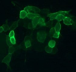 Invitrogen CNR2 Recombinant Rabbit Monoclonal Antibody (13H43L20) 100 &mu;g;