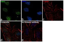 Invitrogen CBX2 Recombinant Rabbit Monoclonal Antibody (21H43L31) 100 &mu;g;