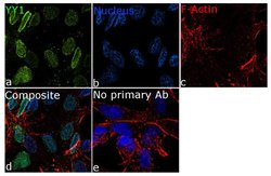 Invitrogen YY1 Recombinant Rabbit Monoclonal Antibody (6H6L1) 100 &mu;g;