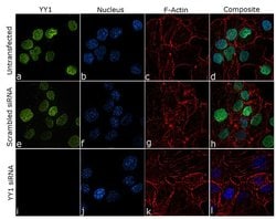 Invitrogen YY1 Recombinant Rabbit Monoclonal Antibody (6H6L1) 100 &mu;g;