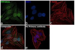 Invitrogen PPP2R1A Recombinant Rabbit Monoclonal Antibody (19H23L31) 100 &mu;g | Buy Online | Invitrogen&trade; | Fisher Scientific