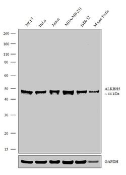 Invitrogen ALKBH5 Recombinant Rabbit Monoclonal Antibody (10H24L9) 100 &mu;g | Buy Online | Invitrogen&trade; | Fisher Scientific