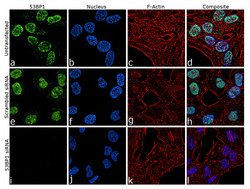 Invitrogen 53BP1 Recombinant Rabbit Monoclonal Antibody (7H14L12) 100 &mu;g;