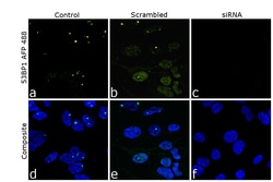 Invitrogen 53BP1 Recombinant Rabbit Monoclonal Antibody (7H14L12), Alexa