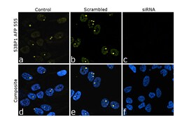 Invitrogen 53BP1 Recombinant Rabbit Monoclonal Antibody (7H14L12), Alexa