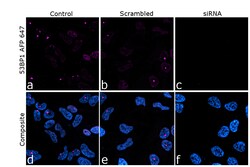 Invitrogen 53BP1 Recombinant Rabbit Monoclonal Antibody (7H14L12), Alexa
