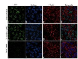 Invitrogen CHD8 Recombinant Rabbit Monoclonal Antibody (20H56L8) 100 &mu;g;