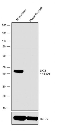 Invitrogen&trade;&nbsp;LHX6 Recombinant Rabbit Monoclonal Antibody (1H30L22)