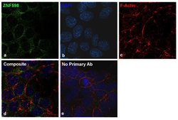 ZNF598 Recombinant Rabbit Monoclonal Antibody (5H5L17), Invitrogen 100