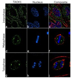 Invitrogen TAOK1 Recombinant Rabbit Monoclonal Antibody (13H2L16) 100 &mu;g;