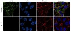 Invitrogen DAPK1 Recombinant Rabbit Monoclonal Antibody (7H2L3) 100 &mu;g;