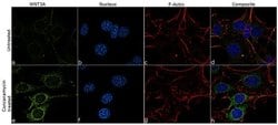 Invitrogen WNT3A Recombinant Rabbit Monoclonal Antibody (1H12L14) 100 &mu;g;