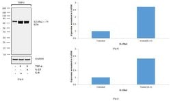 IL13RA2 Recombinant Rabbit Monoclonal Antibody (2H25L68):Antibodies, Recombinant