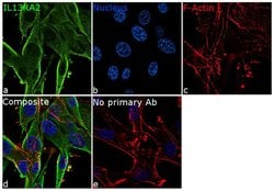 IL13RA2 Recombinant Rabbit Monoclonal Antibody (2H25L68):Antibodies, Recombinant