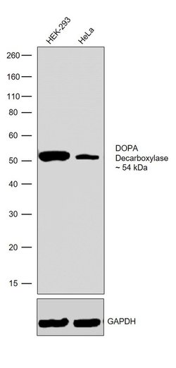 Invitrogen DOPA decarboxylase Recombinant Rabbit Monoclonal Antibody (1H21L22)