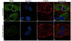 Invitrogen PKM2 Recombinant Rabbit Monoclonal Antibody (3H18L21) 100 &mu;g;